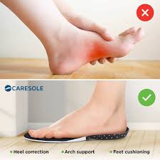 CareSoles Plantar Pro Insoles  Control Expert Analyzes Everyone